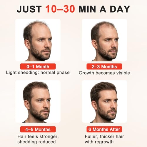 Image of Red Light Hair Growth Cap - FDA Cleared Red Light Therapy for Hair Growth for Men & Women