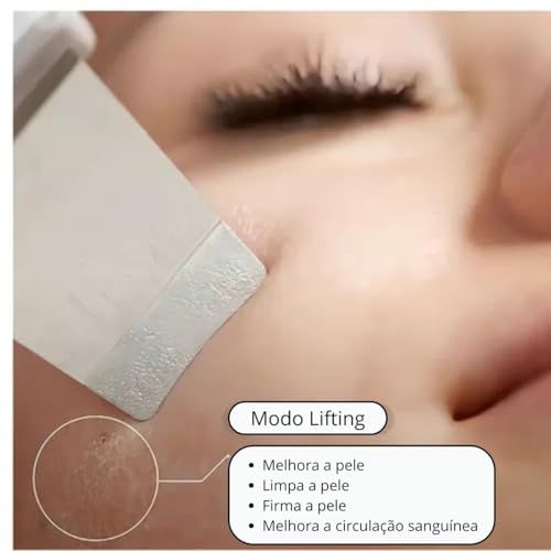 Espátula De Peeling Ultrassônico E Ionização Facial Removedor Cravos Portátil Limpeza Profunda Skin