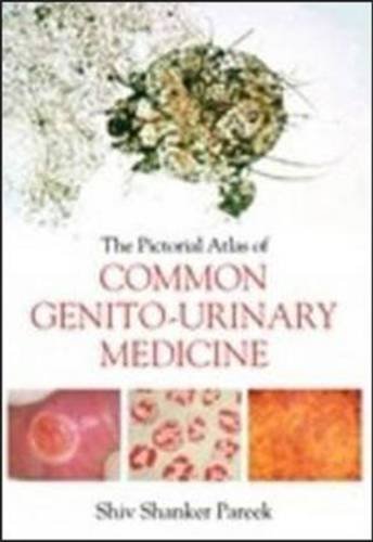 The Pictorial Atlas of Common Genito-Urinary Medicine by Shiva Pareek (2012-02-15)      Paperback – January 1, 1844