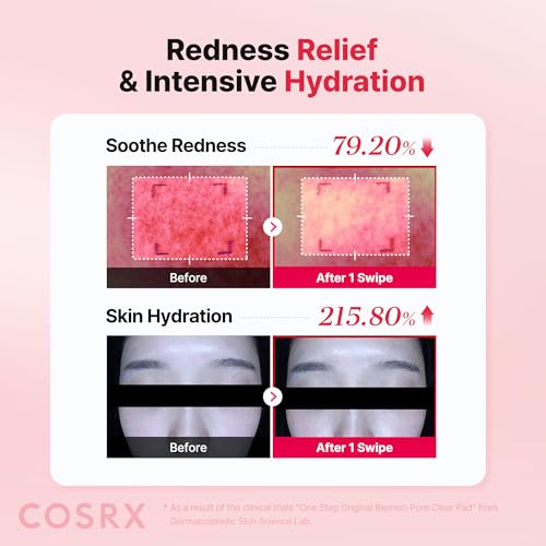 Image of COSRX OneStep Original Blemish Pore Clear Pad, 100 Pads, Dual-Sided Facial Pad for Exfoliation, Pore Care & Hydration with BHA, PHA & Zinc PCA & 5 Hyaluronic Acid, Korean Skin Care