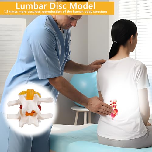 Image of breesky Human Anatomical Lumbar Disc Herniation Model:1.5 Times Life Size Lumbar Disc Teaching Model Tool-for Medical & Learning & Teaching and Scientific Presentations