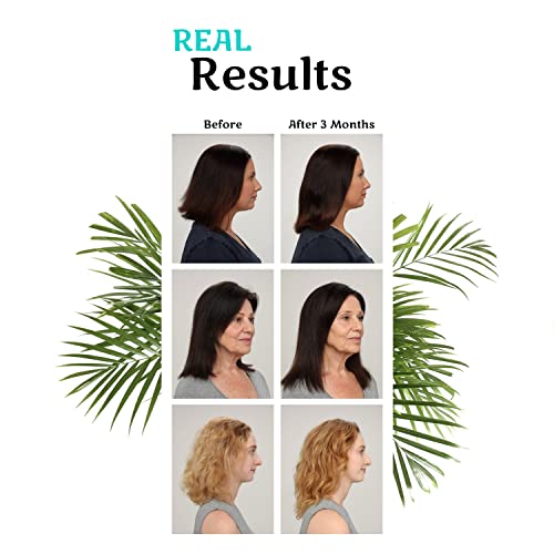 image for Hair La Vie Clinical Formula Hair Growth Vitamins for Women and Men wi