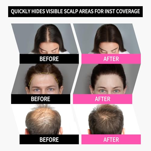 Sevich Hairline Powder 2.0, Instantly Conceals Hair Loss, Root Touch up Powder, Hair Shadow Toppers for Women & Men Thinning Gray Hair, Windproof & Sweatproof, 48H Makeup Lasting, Dark Brown