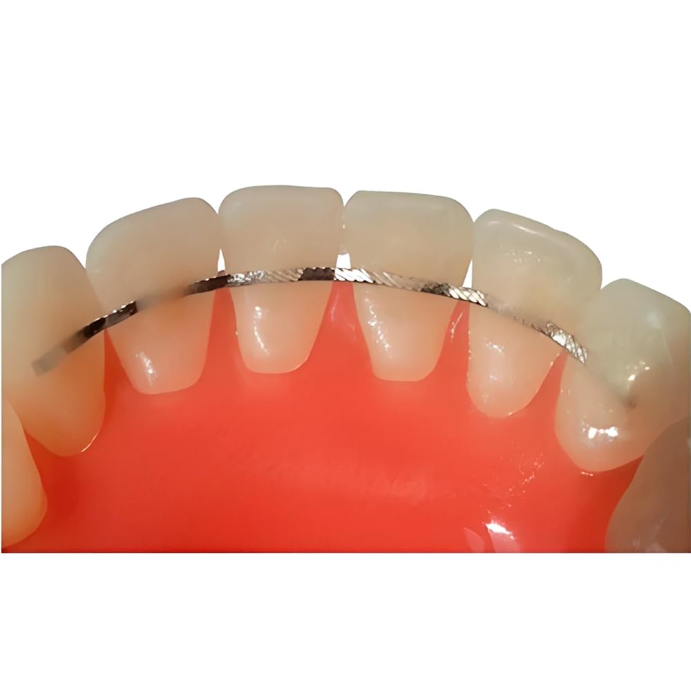 Flat Lingual Retainer Stainless Steel Braid Wire Easy to Adapt and Prevents inadvertent Tooth Movement Size .010" x .028" Made in USA Orthodentalusa Corp. (Stainless Steel Braid Wire)
