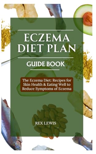 Eczema Diet Plan Guide Book: The Eczema Diet: Recipes For Skin Health & Eating Well To Reduce Symptoms Of Eczema