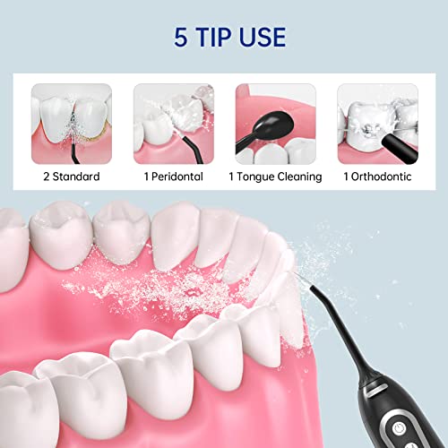 Cordless Water Flosser Teeth Cleaner With 5 Diy Modes And Tips, Professional Portable Dental Oral Floss Irrigator For Braces, Ipx7 Waterproof, Detachable 300Ml Water Tank For Home Travel #TOP1