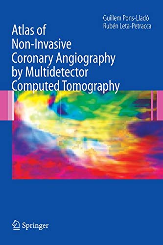 Buy Atlas of Noninvasive Coronary Angiography by Multidetector Computed Tomography โ BookShops.in