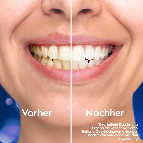 Oral-B 3DWhite Zahnpasta, Clinical Intensive Whitening, 2X 75ml – Ansicht 3