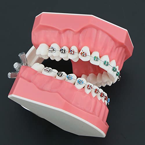 Orthodontic Model Dental Models 1:1 Standard Typodont Teeth Model M7010-2 Demo Teach Study With Archwire Ligature Ties Metal Brackets Buccal Tubes #TOP1