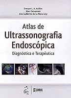 Atlas de Ultrassonografia Endoscópica. Diagnóstica e Terapêutica 8572889728 Book Cover