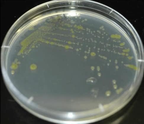 Essential Bacteria Growing Kit. NEW SCIENCE KIT. Pre-Poured Agar Plates (100mm Diameter) & Swabs. Great For Learning About Microbiology. Free Project Guide eBook Available by Request.