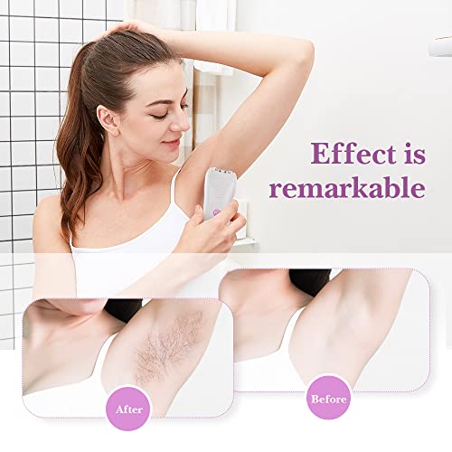 Epilator For Women Epilator For Women Facial Hair Removal Epilator Hair Removal For Women Facial Hair Removal For Women Leg Arm Bikini Armpit Smooth Glide Epilator For Women Facial Hair #TOP5