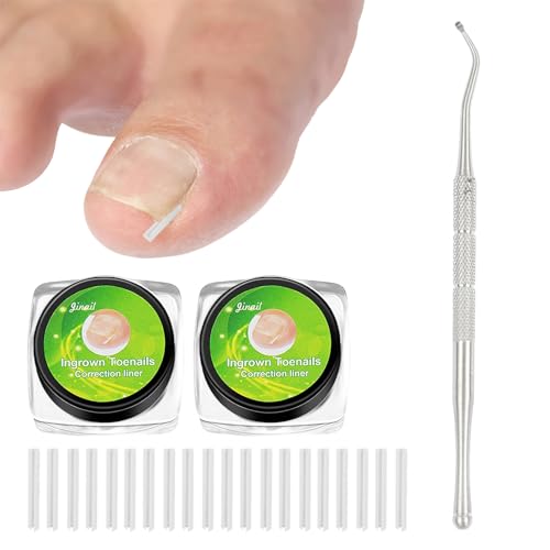 Ingrown Toe Nail Correctors, 101 Pcs Ingrown Toenail Set, Clear Plastic Toenail Corrector with Nail Remover, Straightener Strips for Women Men Foot Care