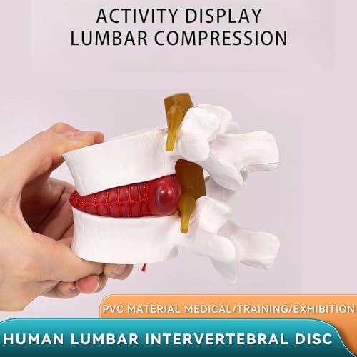 Modelo de columna lumbar con disco intervertebral aumentado 1,5X 3