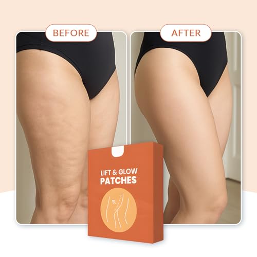 30Pcs Heynip Thigh Lift Tape, Cellulite Tape for Legs Thigh Lift, Thigh Tape Lifting Invisible, Waterproof Body Leg Tape for Sagging Skin, Tummy Arms, Lift and Glow Patches Legs for Women2