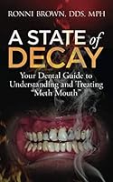 A State of Decay: Your Dental Guide to Understanding and Treating "Meth Mouth" 1732562482 Book Cover