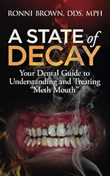 Paperback A State of Decay: Your Dental Guide to Understanding and Treating "Meth Mouth" Book