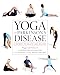 Yoga and Parkinson's Disease: A Journey to Health and Healing