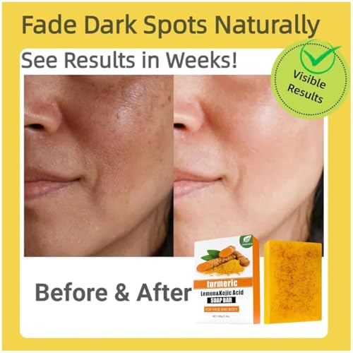 Uselective 2 Pack Turmeric & Lemon Glow Soap Bar - Botanical Duo Power for Dark Spots, Skin Brightening with Kojic Acid, Vitamin C，Retinol- 3x Moisturizing with Amino Acid & Shea Butter - SLS Free