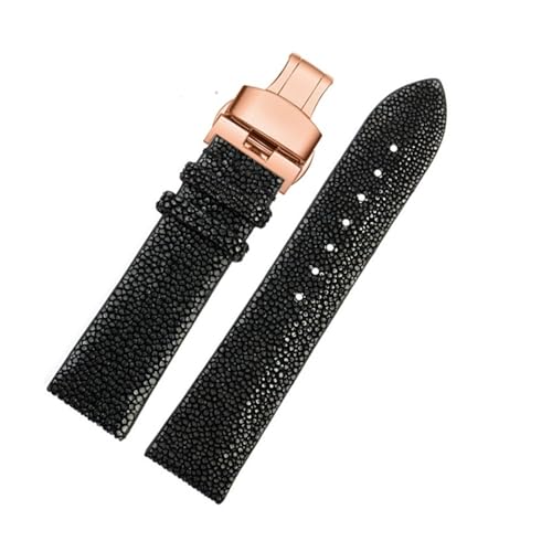 [DNYXGDGSL] p[tBbVXgbvHuaweiATISSOTAIKA~h[AYAfB[X̃frEHb`ohANZT[20mmA22mmA16mmɑΉĂ܂B(Black RG,20mm)