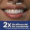Waterpik Idropulsore Dentale Ultra Professional con 6 Testine e Sistema Avanzato di Controllo della Pressione con 10 Impostazioni, Strumento di Rimozione della Placca Dentale, Blu(WP-663EU)