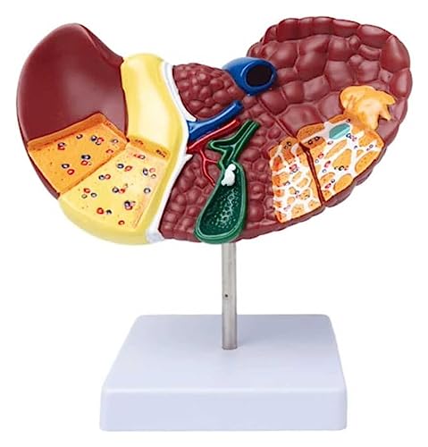 Higado humano anatomico de tamano natural didactico con caracteristicas patologicas 2