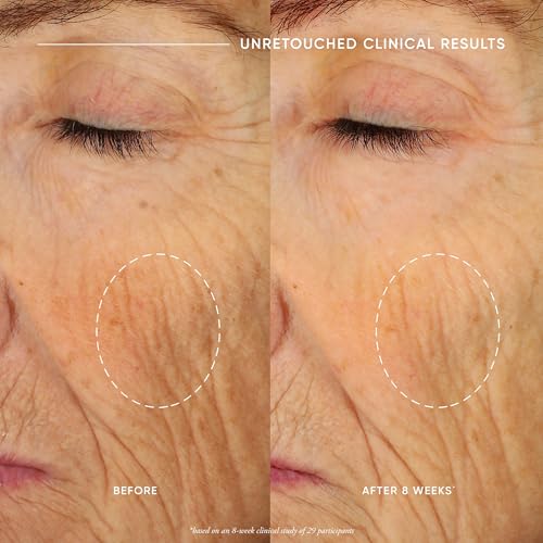 philosophy ultimate miracle worker cream 60ml, nourish & rejuvenate face and neck, moisturiser with patented retinol complex - Image 4