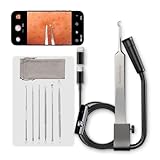 Luma 1 Visuelle Mitesser-Entferner Pinzette mit Kamera – Pimple Popper Tool mit 20-facher Vergrößerung, 1080P, 8 LED-Lichtern, inklusive Mitesser-Entferner-Set (6-teilig), Schwarz