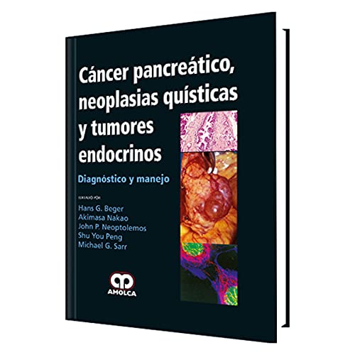 Cancer Pancreatico Neoplasias Quisticas y Tumores Endocrinos