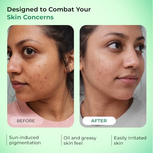 Image of Conscious Chemist 100% Mineral Sunscreen Ultra Light Fluid 50ml | SPF 50 PA++++ | In-Vivo Tested | Zinc Oxide & Niacinamide | Cica Exosome | Matte Finish, Sweat Resistant | No White Cast | For Oily, Acne-Prone & Sensitive Skin | UVA /UVB Protection | Men & Women, All Skin Type - Pack of 2