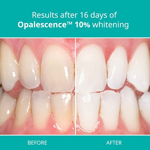 Opalescence At Home Teeth Whitening - Teeth Whitening Gel Syringes - 4 Pack Of 10% Syringes - Mint #TOP5