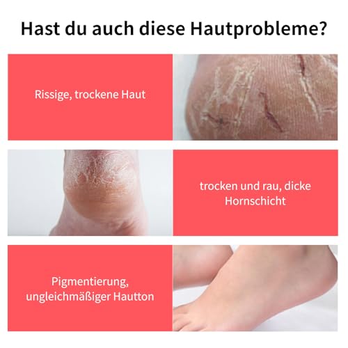 Hydrating and Anti Cracking Foot Cream,Feuchtigkeitsspendende und Anti-Riss-Fußcreme,Urea Fußcreme für sehr trockene,rissige Haut,Fußpflegecreme für Füße,Hände & Ellbogen,Fusscreme Sehr Trockene Füsse – Bild 6