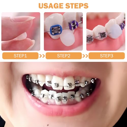Opiniones y reviews de Cera para brackets precio , tabla con los diez mejores. 22 Imagen adicional