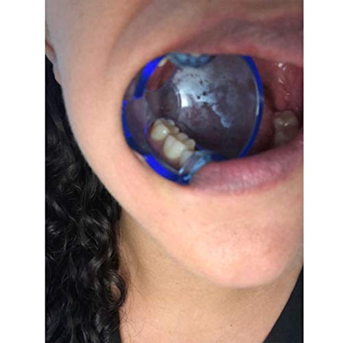 Smiledt-Dental-Orthodontic-Lip-Cheek-Retractor-Expander-Mouth-Opener-Autoclavable-for-Posterior-Teeth-15-Pieceslot