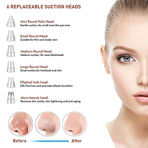 Miniatura 2 de Aspiradora de poros para eliminar puntos negros, dispositivo limpiador de poros facial, herramienta extractora de acné, 5 sondas, kit de aspiradora