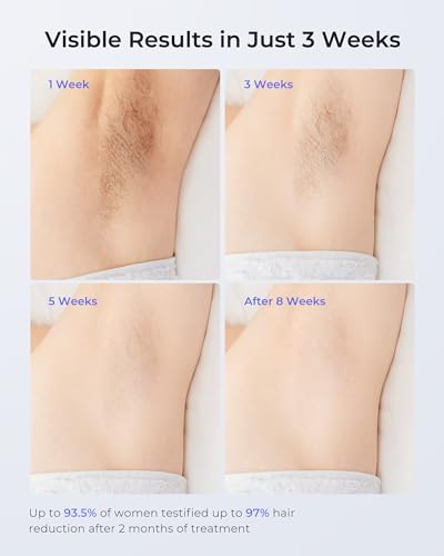 LUBEX Painless Sapphire Ice Cooling IPL Laser Hair Removal Device at Home for Women & Men, 1,000,000+ Unlimited Flashes, Safe and Permanent, Alternative to Salon Hair Removal for Legs Bikini Face Body - Image 4