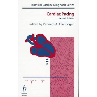 Cardiac Pacing
