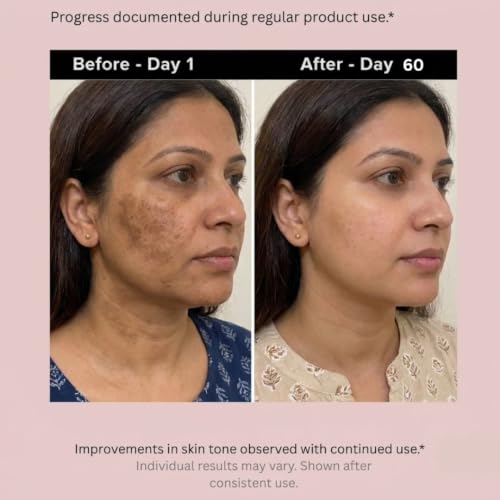 Image of 2% Alpha Arbutin Serum for Glowing and Brightening Skin | Face Serum For Men & Women with Glutathione helps reduce Dark Spot, Pigmentation and Melasma (30 Ml)