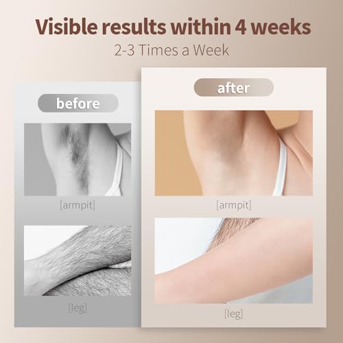 Huotwoe Upgraded Flashes IPL Permanent, Device with 5 Levels Adjustable for Women & Men\'s Facial Legs Arms Bikini Line at-Home Use - Thumbnail 4
