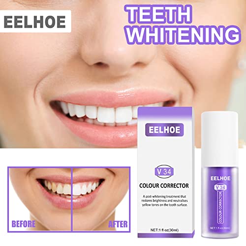 Teeth Cleansing Toothpaste Tooth Whitening Enamel Care Toothpaste Stains, Teeth Whitening Toothpaste Sensitive Teeth, Intensive Stain Removal Teeth Reduce Yellowing, A-2Pcs #TOP2