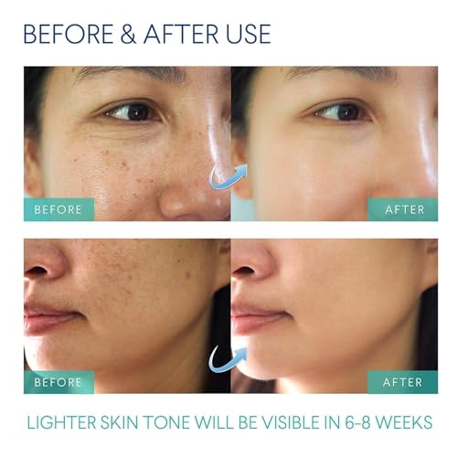 Razor Bumps Treatment for Women and Men, Ingrown Hair Treatment, Razor Bump Treatment for Bikini Area, Face, Neck, Legs, and Underarm Area, After Shave for Women and Men, Ingrown Hair Serum