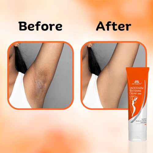 INTIMIFY Underarm Whitening Cream for Women, Armpit Whitening Cream Natural with Kojic Acid & Vitamin B3 20g