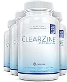 ClearZine Acne Solution - Best Natural Acne Pills for Rapid Acne Treatment and Radiant Skin | Reduce Skin Redness and Breakouts for Clear Skin with Pantothenic Acid and Zinc, 90 Capsules (4 Bottles)