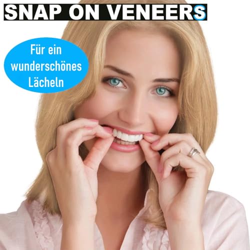 Zahnblende Mavura SnapOnVeneers Kosmetische Zahnprothese