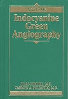Atlas of Indocyanine Green Angiography 0896403106 Book Cover