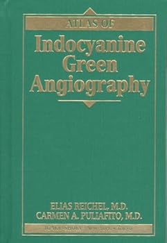 Hardcover Atlas of Indocyanine Green Angiography Book