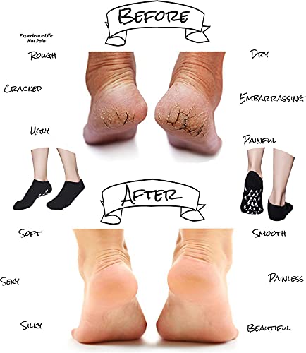 Moisturizing Socks, Gel Socks Soft Moisturizing Gel Socks, Gel Spa Socks For Repairing And Softening Dry Cracked Feet Skins (Men Size(Black)) #TOP3