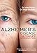 Alzheimer's Disease: The Complete Introduction (Your Health, 1)