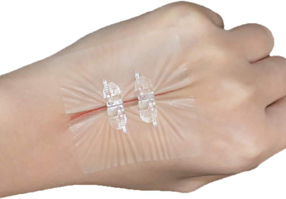 Buy Zipper Bandaid SutureFree, Zip Stitch Wound Closure kit, Surgical