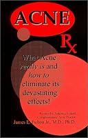 Acne RX 0971281009 Book Cover